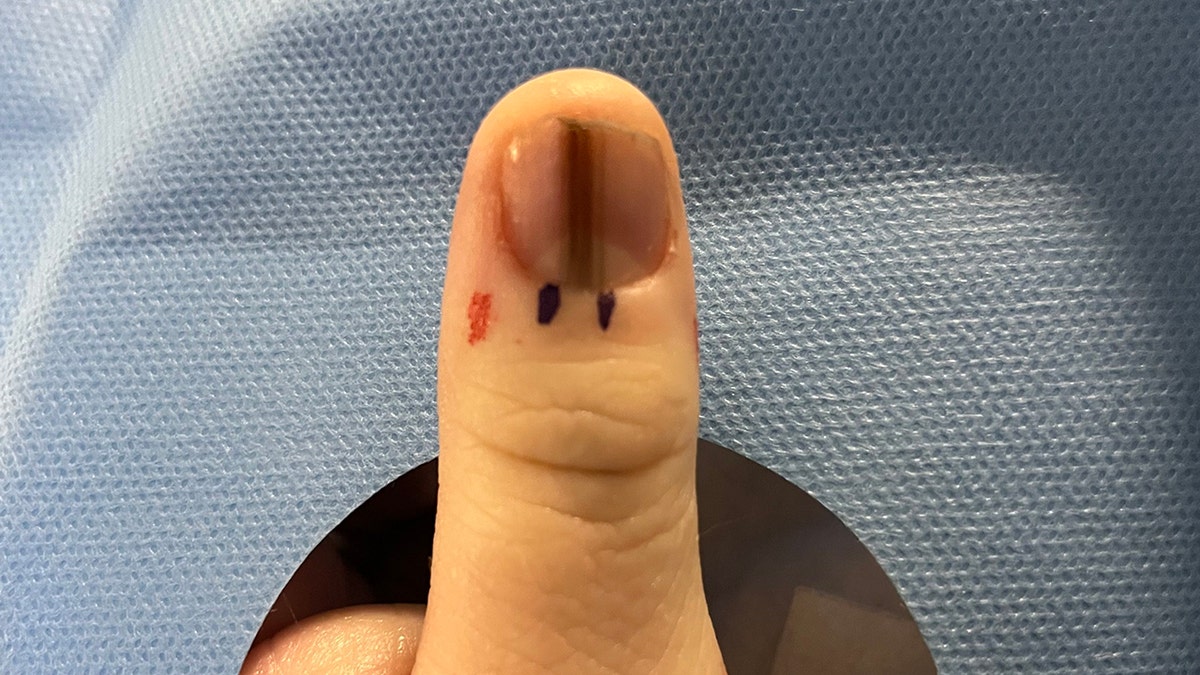 Lauren Koltcz's brown line on her left thumbnail.