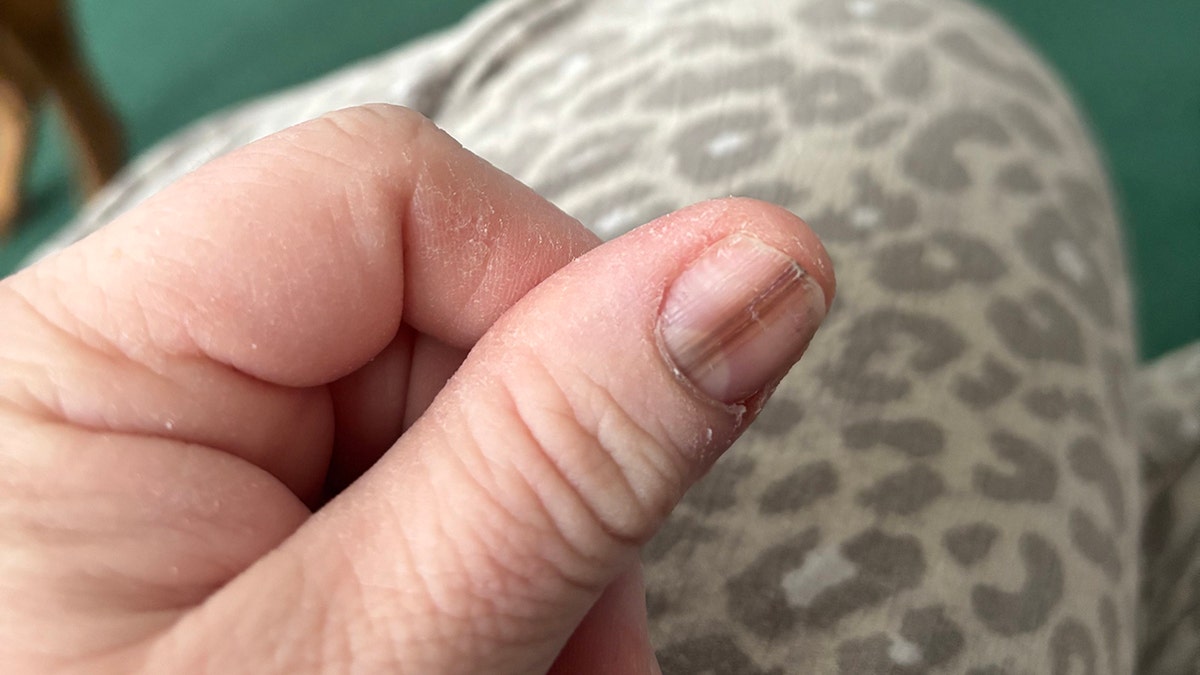 Lauren Koltcz's brown line on her left thumbnail.