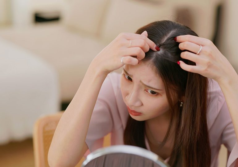 Hairstylists and medical expert confirm temporary hair loss affecting Ozempic users