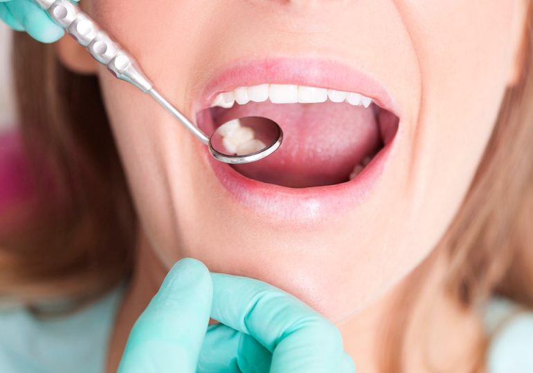 Most common causes of cavities in the teeth — and how to prevent them