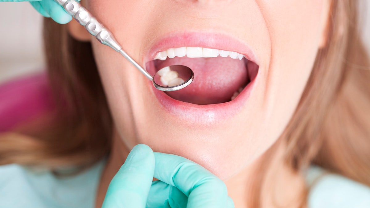 Cavities are holes in your teeth through which bacteria can reach vulnerable inner parts of the teeth.