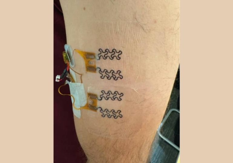 Smart wearable tracks your hydration in real time