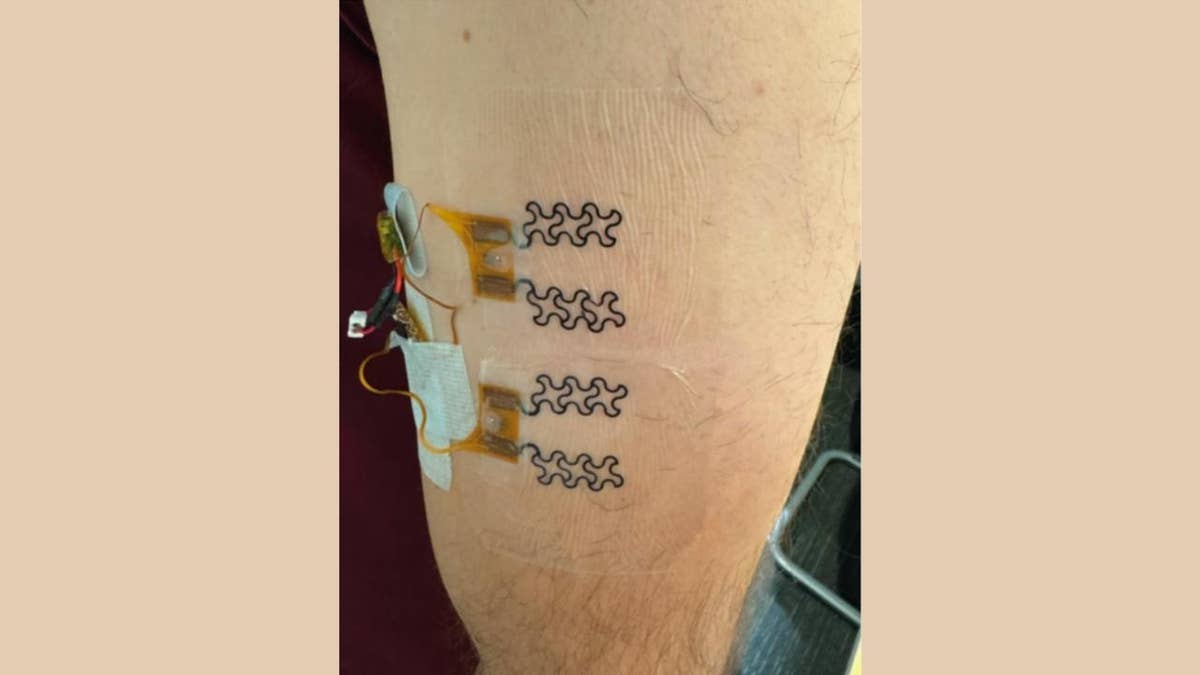 Single-side electrode configuration setup using hydration bioimpedance sensor.