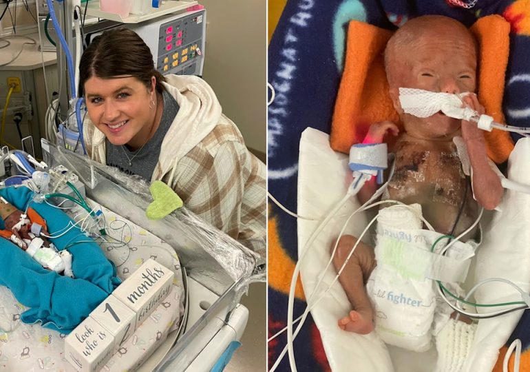 World's most premature baby defies all medical odds to reach 1st birthday