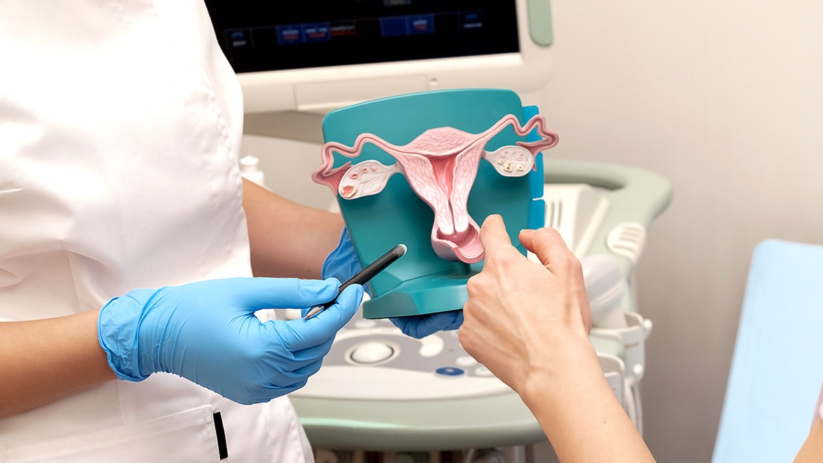 Gynecologist talks to a patient with a model of the female reproductive system in her hands.