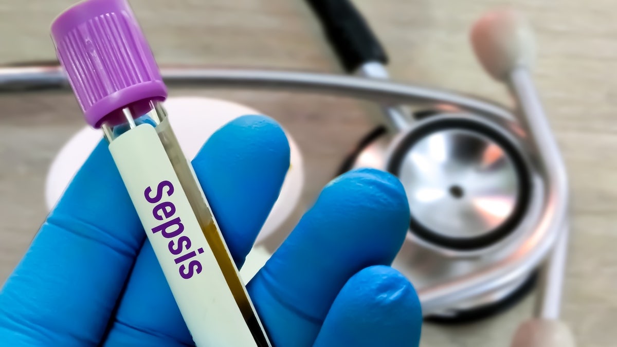 Sepsis blood test