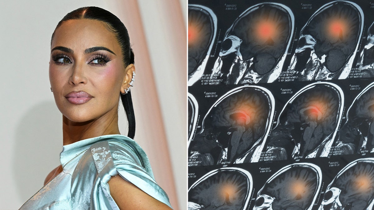 split image of kim kardashian and a brain MRI scan