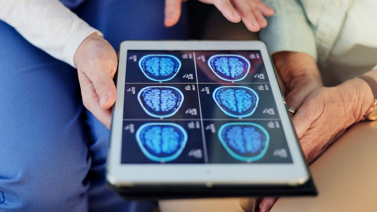 Doctor and patient brain scan