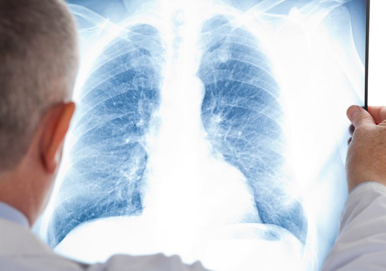 The deadly cancer hiding in plain sight — and why most patients never get screened