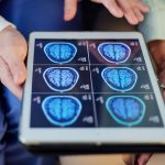 Common supplements deliver breakthrough results against brain cancer in early study