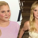 What to know about Cushing’s syndrome, which led to Amy Schumer’s dramatic weight loss