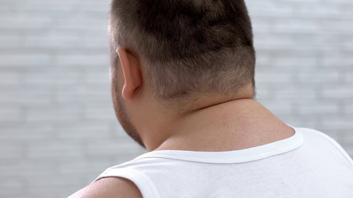 hump on the back of a man's neck