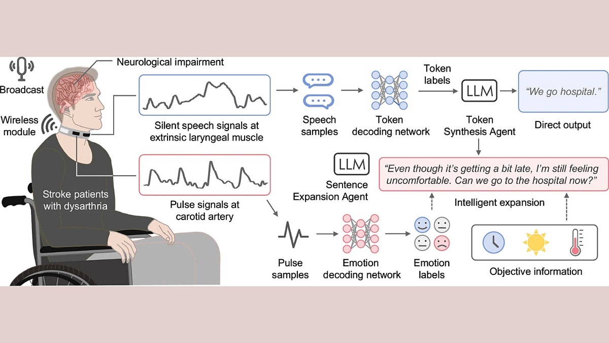 A diagram of how the Revoice device works on a patient